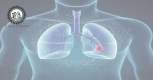 Ilustração sobre tromboembolismo e sua interpretação pela medicina biomédica e pelo Ayurveda.