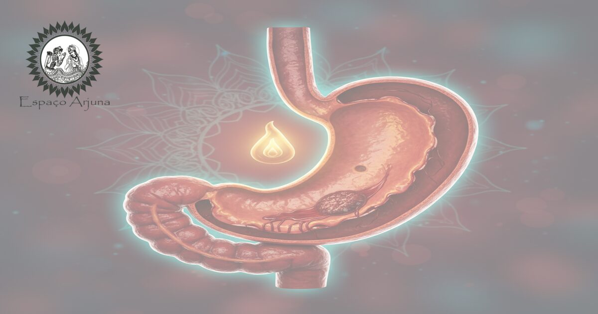 Imagem ilustrativa de úlcera péptica com sangramento e perfuração